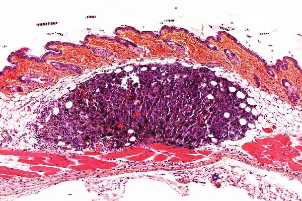 HISTO-PATHOLOGIE